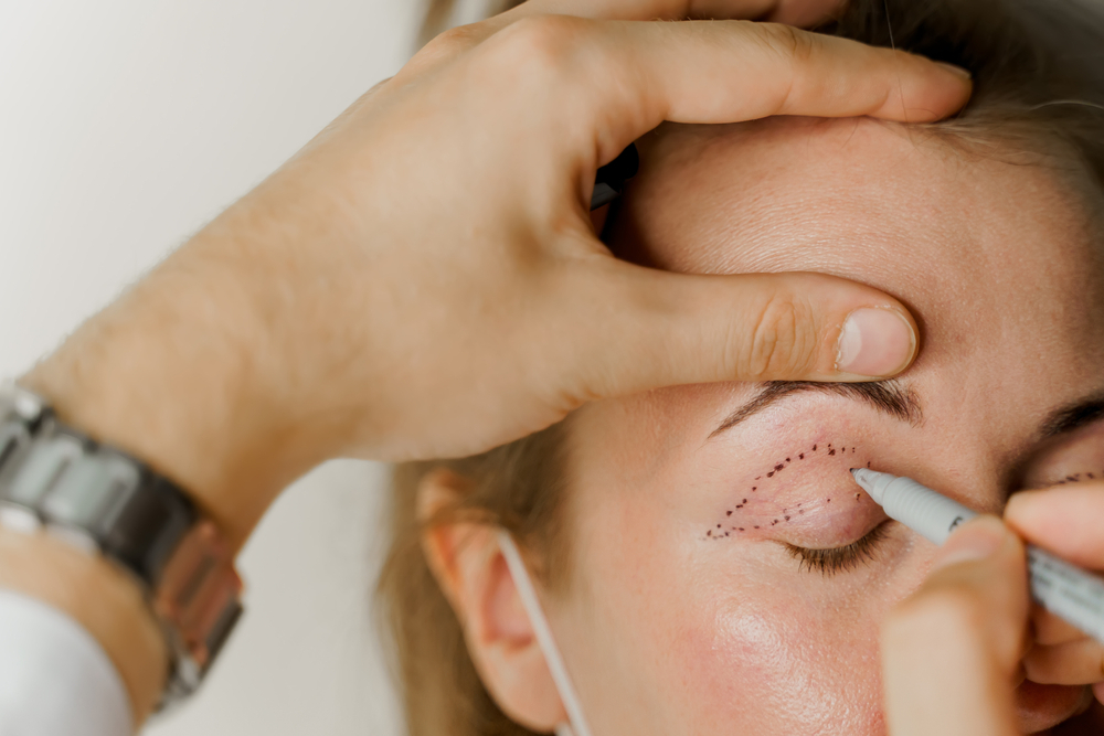 Eyelid Surgery in Glenview, IL